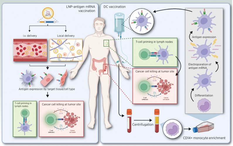 Figure 2. Overview of active mRNA-based immunotherapeutic strategies. Left, LNP-antigen mRNA vaccine delivered systemic or locally, followed by antigen expression resulting in T-cell priming and eventually cancer cell killing. Right, monocytes or hematopoietic progenitor cells are isolated from blood, further cultured, and differentiated into DCs. mRNA is then used to load the DCs ex vivo with tumor antigens. The modified DCs are administered to patients, where they will prime T cells resulting eventually in the killing of cancer cells. Adapted from an image created with BioRender.com.