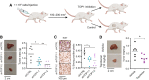 Figure 4. TOP1 is a MYC-SL vulnerability in vivo. A, Schematic of 10A.PM xenograft experiments to evaluate effect of TOP1 inhibition on tumor growth. B, Tumor weights and representative images in 10A.PM xenografts following 18 days of TOP1 knockdown by shRNA compared with control shRNA. *, P < 0.05; **, P < 0.01, calculated using one-way ANOVA followed by Bonferroni multiple comparisons test. C, Mouse tumors were fixed, paraffin embedded, and stained for Ki67. N = 6 mice per treatment group except shTOP1–1, where N = 7. *, P < 0.05, calculated using one-way ANOVA followed by Bonferroni multiple comparisons test. D, Tumor weights from 10A.PM xenografts after topotecan treatment. Representative excised tumors shown for each treatment group. N = 7 mice per treatment group. *, P < 0.05, calculated using the Student t test. (A, Created with BioRender.com.)