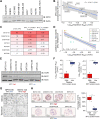 Figure 6. Drug response to TOP1 inhibitors is MYC-driven in breast cancer. A, Western blot analysis showing MYC levels in a panel of breast cancer cell lines. Actin was used as a loading control. N = 3 biological replicates. B, Pearson correlation between MYC protein levels and log10-transformed topotecan IC50 values. Gray, SE of linear regression model. C, Heatmap showing MYC characteristics in breast cancer PDOs. Cells are pseudocolored from high (red) to low (white). D, Pearson correlation between MYC target gene signature enrichment scores and log10-transformed topotecan IC50 values. Biological replicates for each PDO are shown. Gray, SE of linear regression model. E, Western blot analysis showing MYC and TOP1 protein levels in a panel of breast cancer PDOs. Models are stratified into MYC-high and MYC-low categories based on relative detectable signal for MYC protein. F, Log10-transformed topotecan and SN-38 IC50 values in MYC-high and MYC-low PDOs. T tests were performed between groups. **, P < 0.01; ***, P < 0.001. G, Representative images of BPTO.95 (MYC-low) and BXTO.143 (MYC-high) PDOs following 100 nmol/L of topotecan. Scale bars, 100 μm. H, Left, representative images of MYC immunohistochemistry signal in MYC-high and MYC-low breast cancer PDOs. Scale bar values are shown per image. Right, quantification of proportion of MYC-positive nuclei across the panel of PDOs. Student t test was used to determine P values. **, P < 0.01. A minimum of 1,000 nuclei from at least 50 individual organoids was scored for each model.