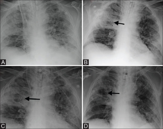 Figure 20 (A-D)