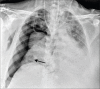 Figure 17