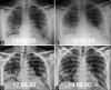 Figure 9 (A-D)