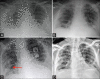 Figure 21 (A-D)