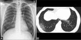 Figure 8 (A and B)