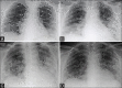 Figure 12 (A-D)