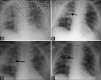 Figure 20 (A-D)