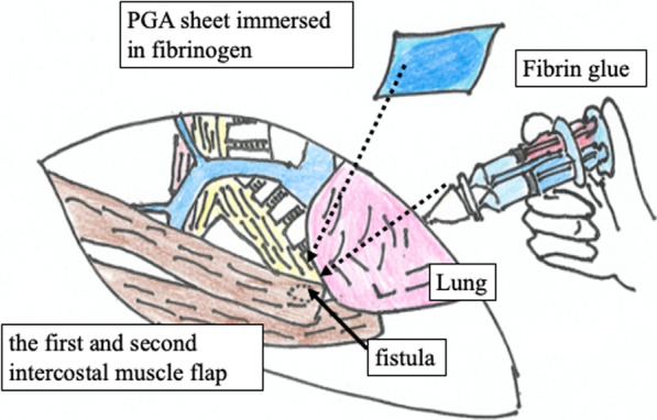 Fig. 2