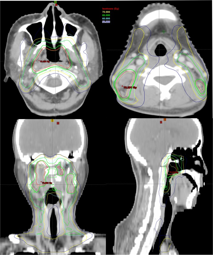 Fig 1