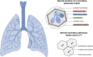 Illustration shows the normal anatomy of a secondary pulmonary lobule and
its corresponding representation at CT.