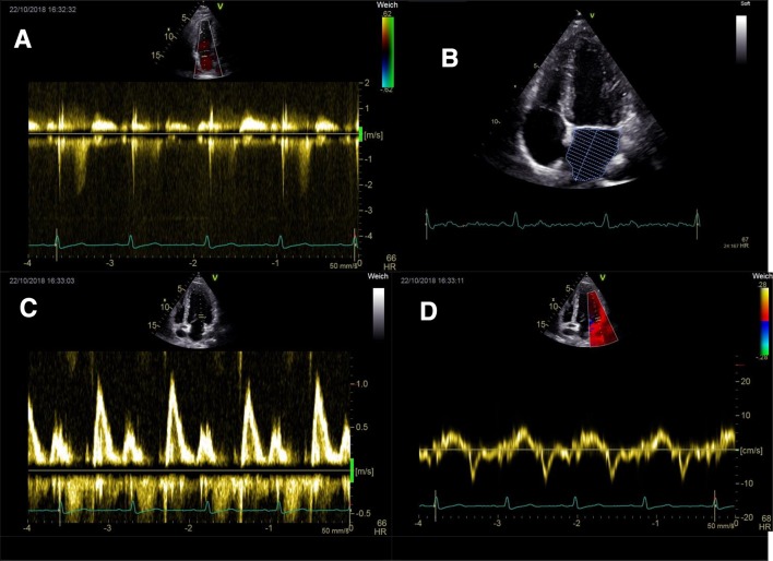 Fig. 3