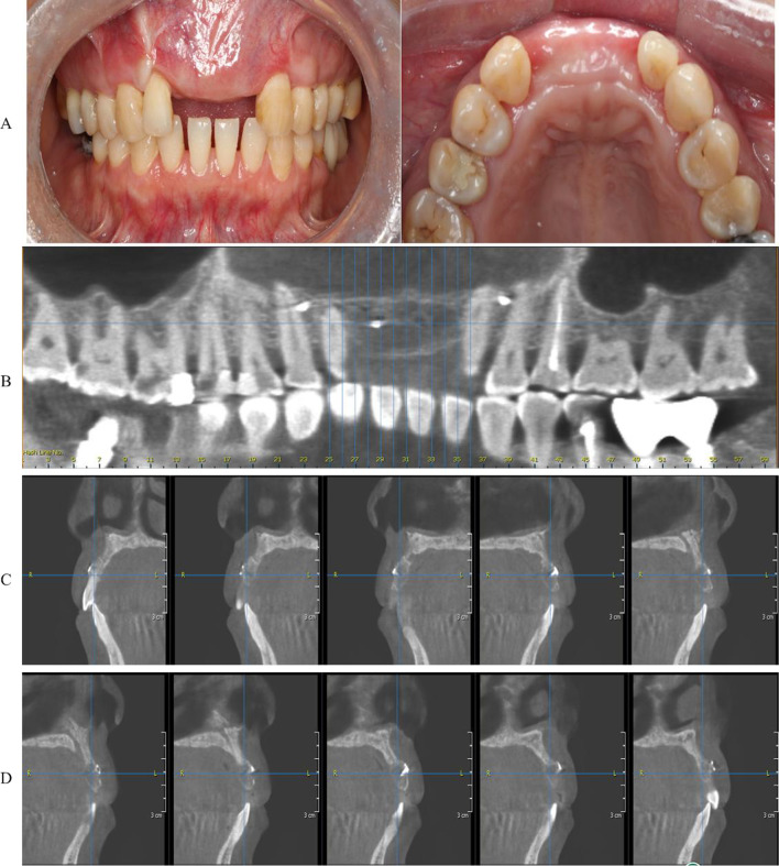 Fig. 5