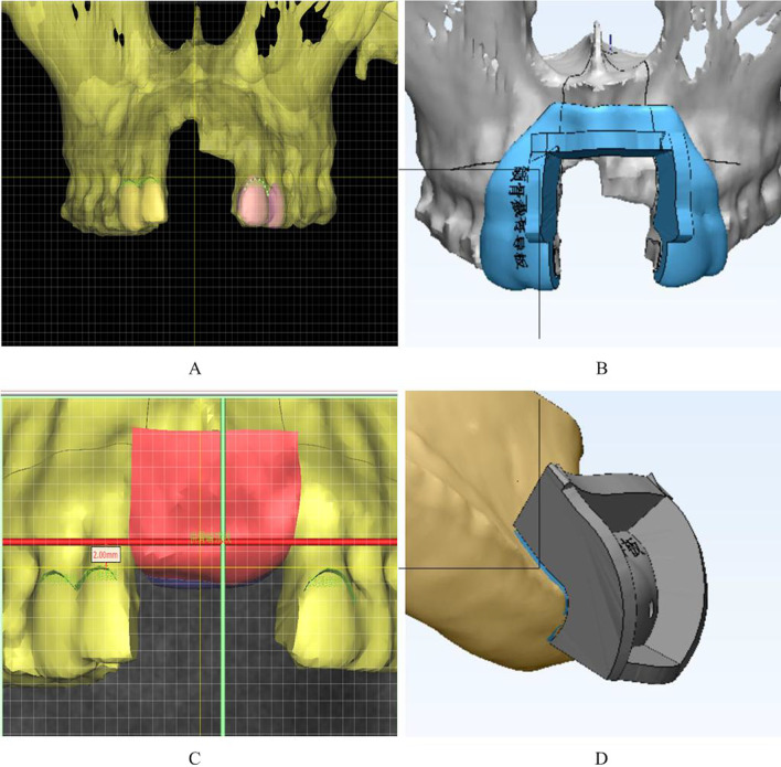 Fig. 3