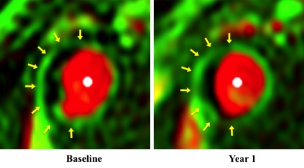 Figure 4: