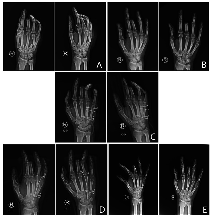 Fig. 3