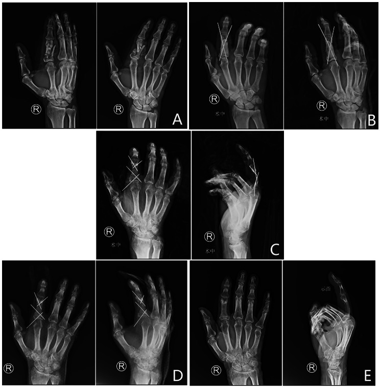 Fig. 4