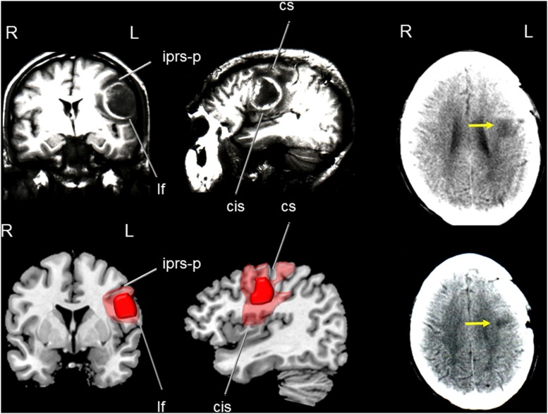 FIGURE 3