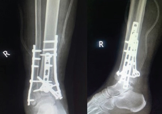 Figure 6