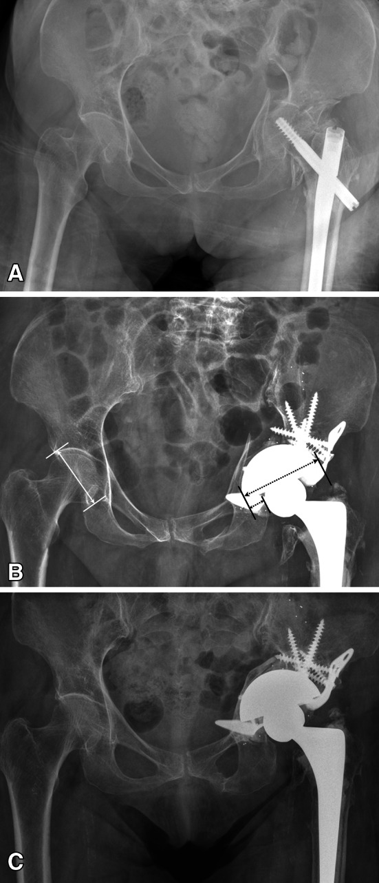 Fig. 1A–C