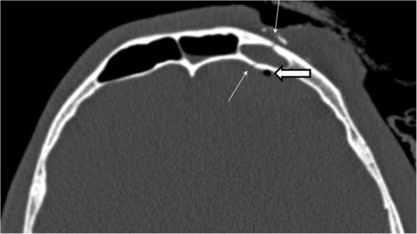 Fig. 14