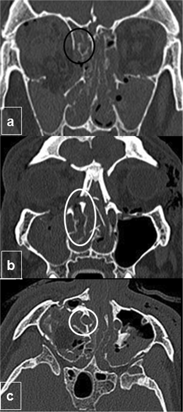 Fig. 5