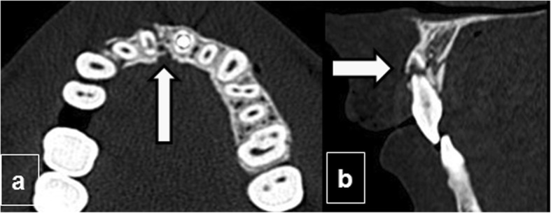 Fig. 15