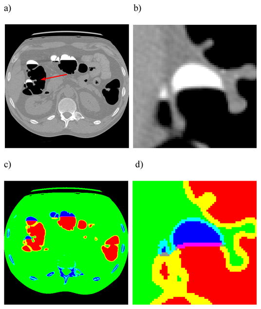 Fig. 5