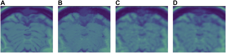 FIGURE 11