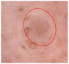 Figure 20