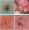 Figure 14