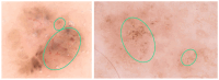Figure 17