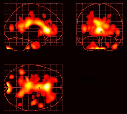 Fig. 4