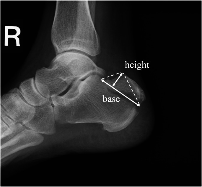 Fig. 1