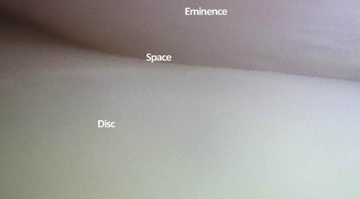Fig. 9