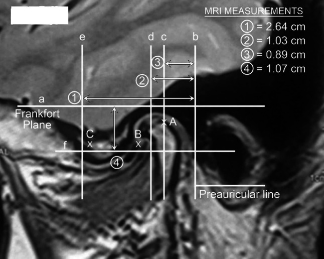 Fig. 2