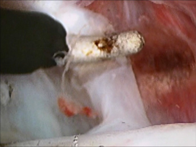 Fig. 13