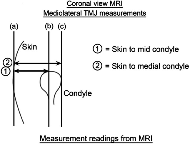 Fig. 3