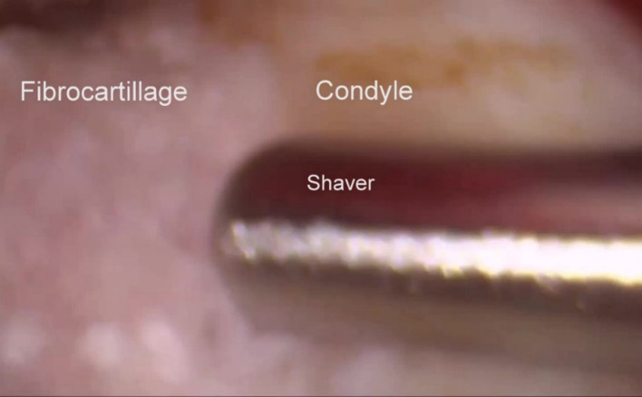 Fig. 20