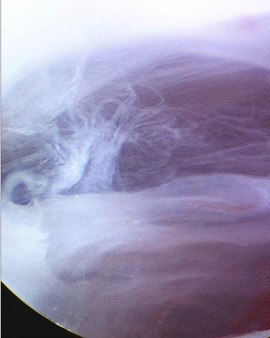 Fig. 12