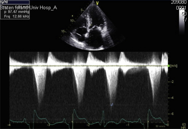 Figure 3