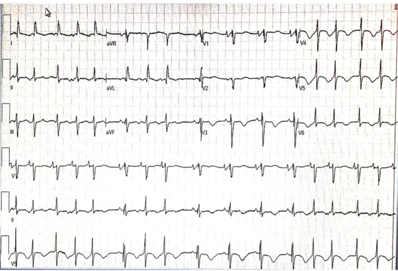 Figure 1