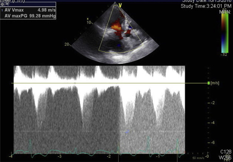 Figure 4