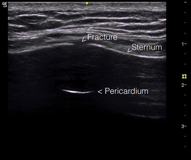 Fig. 1