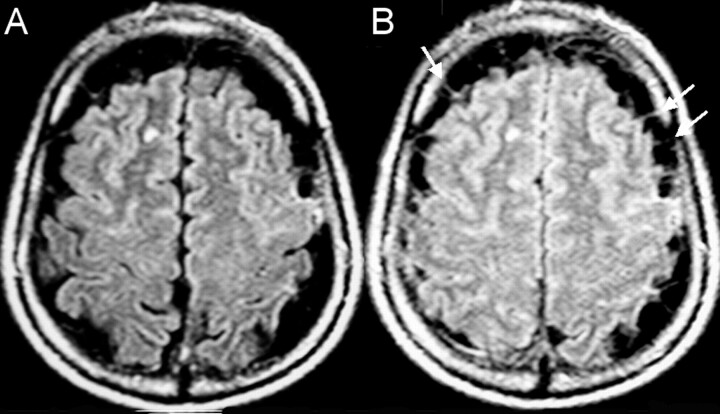 Fig 2.