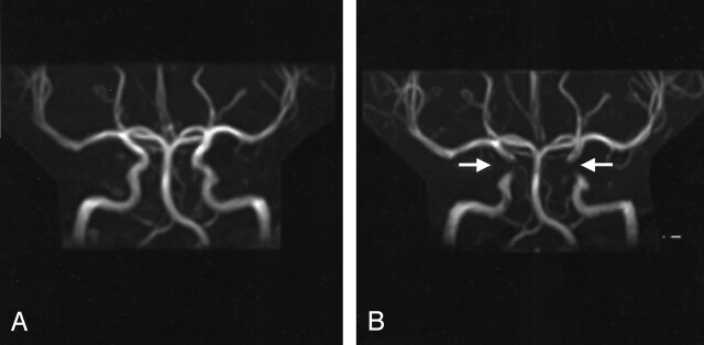 Fig 3.