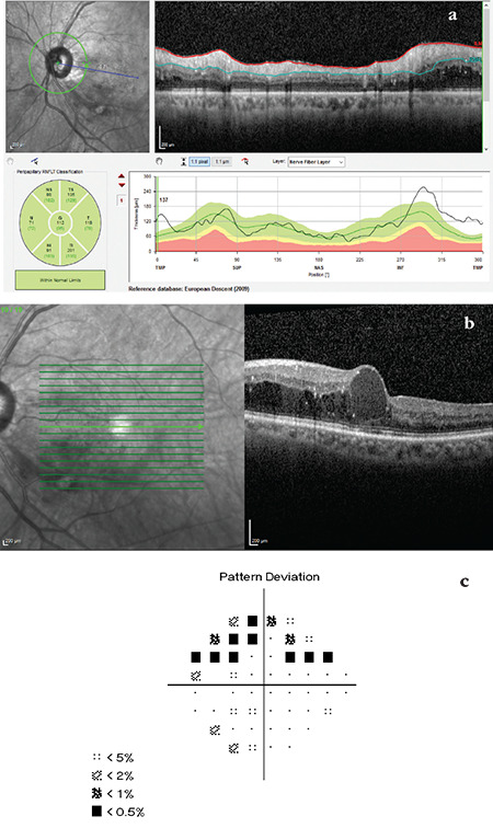 Figure 11