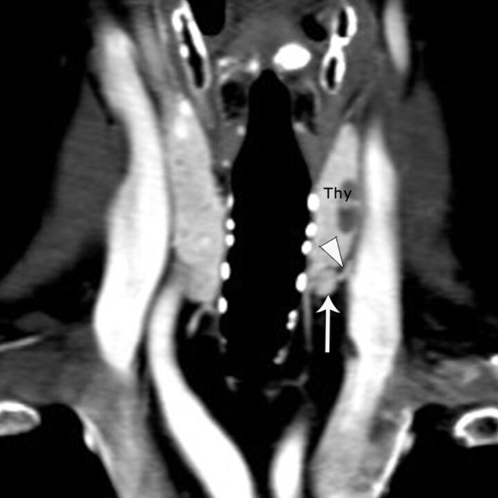 Fig 2.