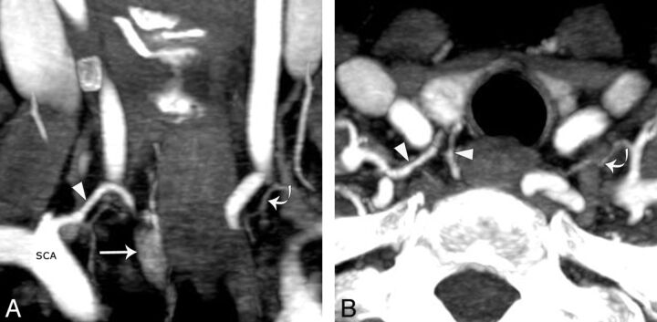 Fig 3.