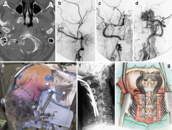 Fig. 4