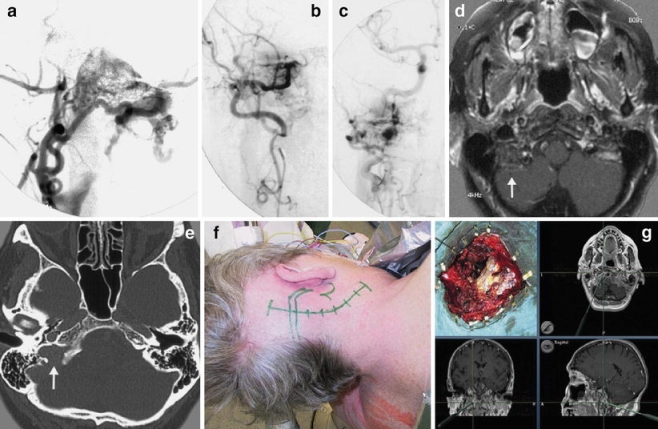 Fig. 3