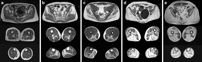 Fig. 1